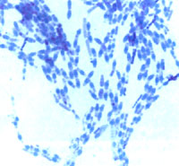 �ÿ�ȸ��Ⱦɫ������ѿ�߸˾�ѿ��