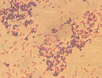 ������Ⱦɫ������΢���¹۲쵽�Ľ�*�������������ɫ���ʹ󳦸˾���ǳ��ɫ��