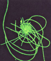 ӫ����΢���µ�˿״ϸ������ϸ��