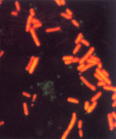 ӫ�⿹��Ⱦɫ֮�󳦸˾�