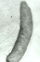 һ�������Ļ����ĳ�΢��Ƭͼ��