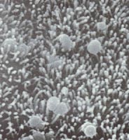 ճ���������ѹ�΢��ë��Ƥϸ���ϵ��ܲ���ɪ�Ͼ���Neisseria gonorrhoeae�������������