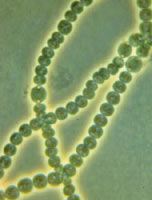 ��������΢���������ϸ����Nostoc���ĵ羵��Ƭ