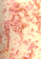 ���������������ƽ�ѿ�߸˾���