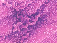 ������θ��Ƥ�ϵ������ݸ˾�