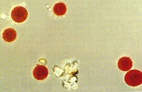 �������ѩ�壩