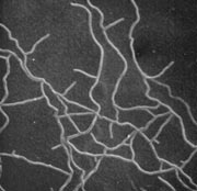 ���߾��ľ�˿����ߣ�5��m����