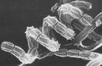 褶皱链霉菌的螺旋形孢子链,孢子表面有褶皱(标尺:1μm)