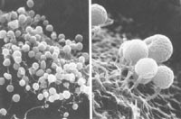 链孢囊菌属的形态