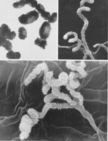 绿色产色链霉菌的螺旋形孢子链,孢子表面有刺(标尺:1μm)