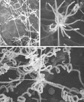北里链霉菌的孢子链轮生(标尺:0.5μm)(上图);玫瑰花链霉菌能登亚种的螺旋形孢子链(标尺:1μm)(下图)