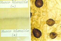 霉菌的接合孢子。左:毛霉的(+)和(-)型菌丝在交界处结合产生黑色的带状,肉眼可见;右:取小黑点用显微镜观察所看到的接合孢子