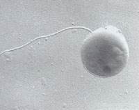 ��������״�Ĺ�����Metallosphaera sedula