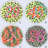 ɫä����������ɫä���˿��ڱ��е�Aͼ�п���29��Bͼ�п���45��Cͼ�п��������֣�Dͼ�п���26����ɫäɫä������Dͼ�н��ܿ���6����ɫäɫä���ܿ���2����ɫ����ɫ��ɫä�ߣ�����A�п���70����C�п���5��ȫɫä�����ķ�ͼ�п������κ����֡�ɫä֢Ҳ��һ���Ŵ��Ի���ȱ�ݼ���������ͬѪ�Ѳ�һ����Ҳ��Ů�������Ŵ������������Ŵ������ԣ�ɫä֢���߶�Ϊ���ԡ�