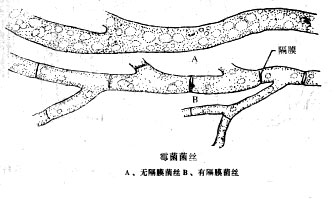 ù���ľ�˿���ϣ��޸�Ĥ��˿���£��и�Ĥ��˿