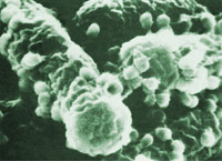 �����ڴ󳦸˾��ϵ��ɾ��塣����ķ�����²�����ʽͨ���󳦸˾��͵��ɾ����ʵ�飬�����˻������������