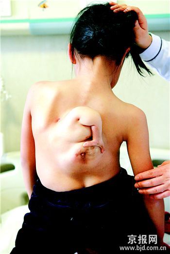 ɽ��Ů�����ϳ�����̥����һ�����(ͼ)