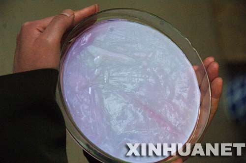 ���������塰����Ƥ����Ӧ���ٴ�(��ͼ)