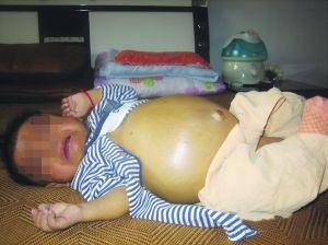 ��Ӥ�ùֲ���������� ȫ������������Σ(ͼ)