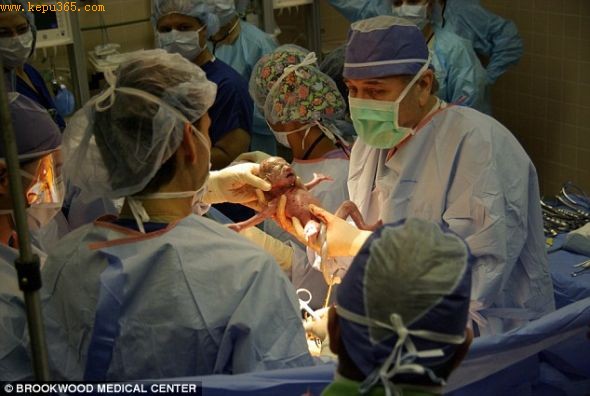 庞大的医疗组：布鲁克伍德医学中心有超过50名专业医护人员参加了卡罗尔的6胞胎剖腹产手术