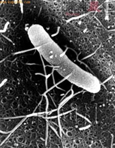 超级细菌照片