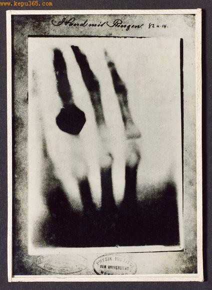 伦琴妻子手指X光照片