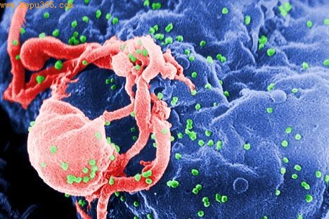这个实验室电子扫描图显示的是白细胞壁上的免疫缺陷病毒(HIV-1)芽接(绿色)
