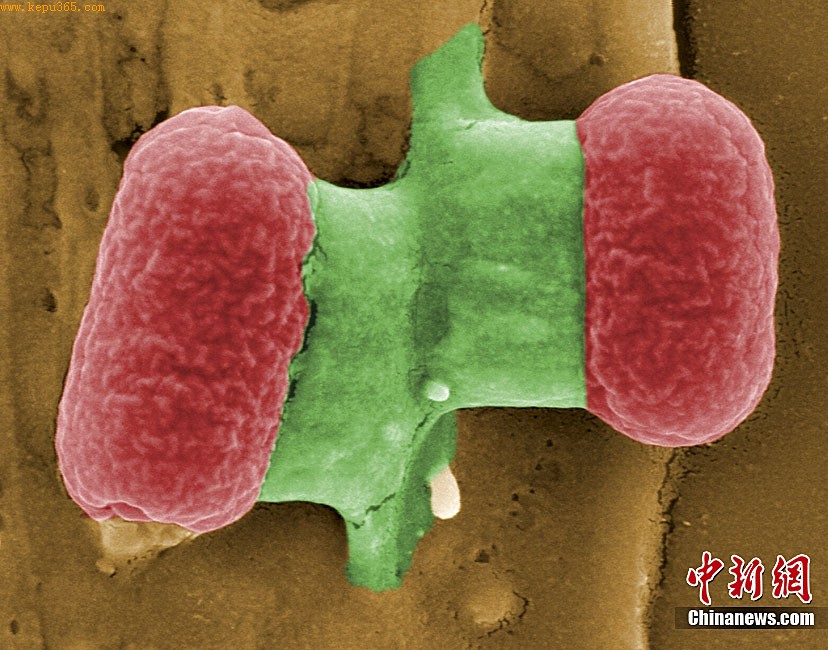 德国公布致命大肠杆茵显微镜下照片
