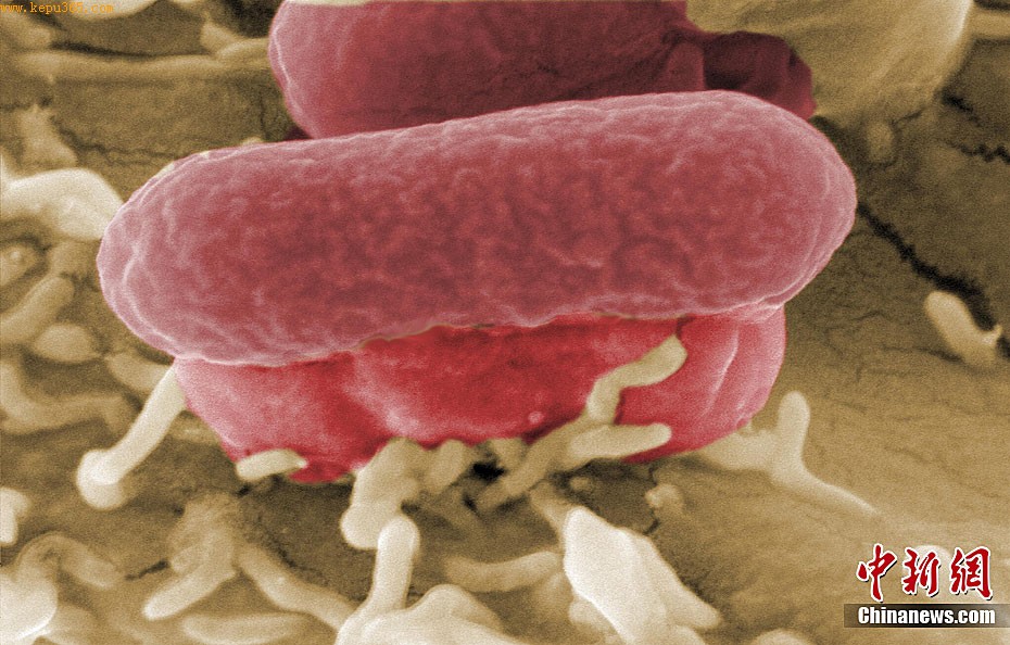 德国公布致命大肠杆茵显微镜下照片