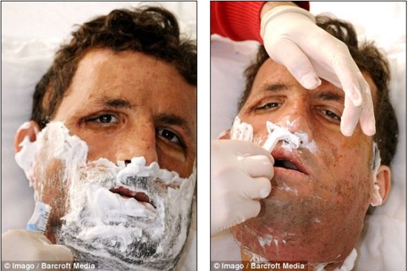 土耳其换脸人尤格尔-阿卡在接受面部移植手术后第一次刮胡子