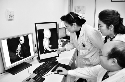 医生们正在察看人鱼胎儿的CT片。