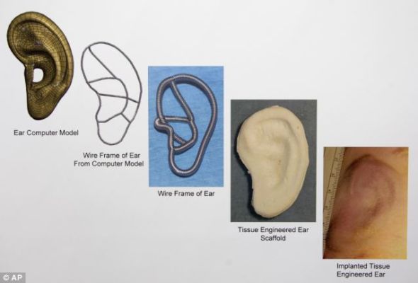 从左向右是移植组织形成耳朵的过程