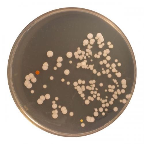 研究发现的大部分微生物种类都属于微球菌属（Micrococcus），为放线菌的种类。