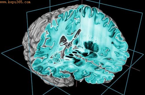 德国科学家创建迄今最高分辨率的人类大脑3D图像模型