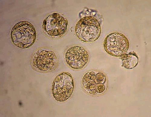 人类胚胎干细胞资料图