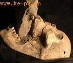 ����Ѫ������ʬ