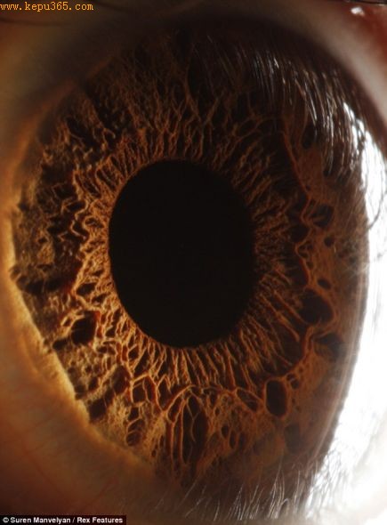 ���۽ṹ��΢�۾�ͷ����ڶ��临�������˲�ͬ����ʶ