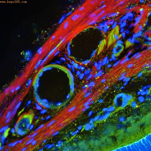 ���۱�����Ƭ